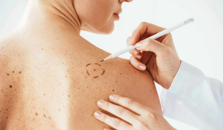 General Dermatology in Leicester