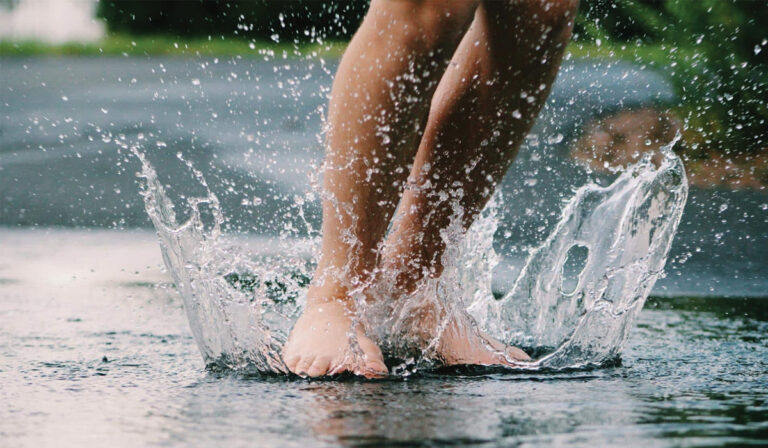 Varicose Veins Removal Leicester